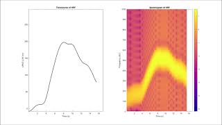 Sonification of fNIRS single channel HRF hemodynamic response function [upl. by Elvia]