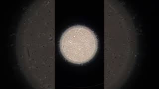 Inside the Lab Sperm Under the Microscope EmbryologyInsights [upl. by Acceber]