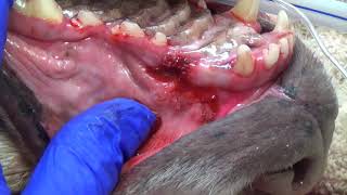 Dental Charting [upl. by Raskind]