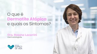 Dra Rosana Lazzarini em Dermatite Atópica [upl. by Neeka]