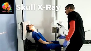 XRay Positioning  Skull SMV view ☢️ YourXRayTech [upl. by Ludie]