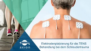 Schleudertrauma  Elektrodenplatzierung für TENS  axion [upl. by Elisa]