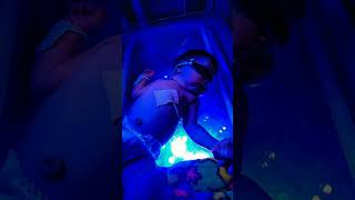 Phototherapy  NICU Baby [upl. by Borries]