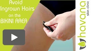 Ingrown Hairs  3 ways to prevent ingrown hairs on your brazilian bikini [upl. by Ahsiruam]