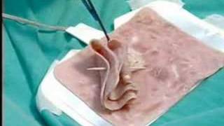 Endoscopia quotLa Historia no Contadaquot parte 6 67 [upl. by Iinden]