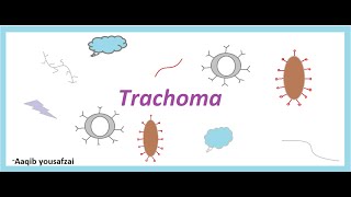 Trachoma  Ophthalmology chlymadial infection of eyes  USMLE step 1 [upl. by Singer]