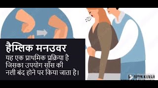 Choking I Heimlich Maneuver I Live saving Technique in Hindi [upl. by Phyllys8]