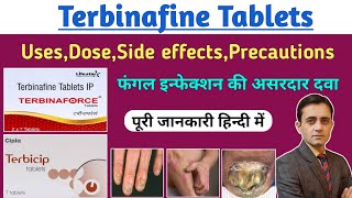 Terbinafine tablets ip 250 mg  Terbinaforce tablet uses dose side effects  फंगल इन्फेक्शन की दवा [upl. by Bannister114]