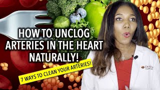 Unclog Arteries In The Heart Naturally 7 Ways To Clean Your Arteries [upl. by Atinad596]