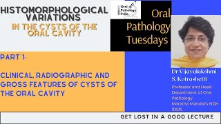 Variations in Cysts of the Oral Cavity part 1 Oral Pathology 360 Fundamantals [upl. by Deirdra]