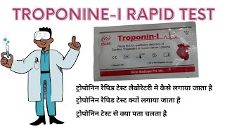 TroponinI Test  Cardiac Troponin I [upl. by Malkin]