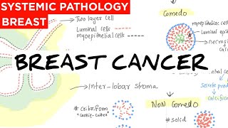 Breast Cancer  Anatomy  causes  classification  Treatment  staging  prognostic amp Risk factors [upl. by Mcgray]