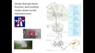 Dr Allie Turton  Stroke rehabilitation The corticospinal tract and beyond [upl. by Ivanna]