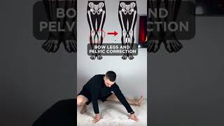 How to get rid of hallux valgus Do this workout 🙌🏻leg valgus posture fit yoga gym backpain [upl. by Drusus]