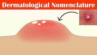 Describing Skin Lesions Dermatological Nomenclature  Macule Papule Pustule Vesicle amp Others [upl. by Hillari]