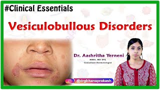 Vesiculobullous disorders Clinical essentials Dr Aashritha yerneni [upl. by Epuladaug]