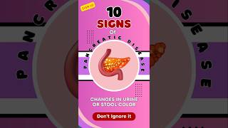 10  Pancreatic Disease Alert Dark Urine or Pale Stools Warning Signs You Shouldn’t Ignore [upl. by Bodrogi]