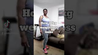 What 30kg weight loss looks like weightlostjourney weightlosssurgery [upl. by Ycram795]