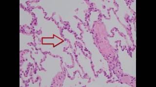 Histology of the Lung [upl. by Ardnassela531]