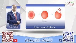 Hématologie  Sphérocytose héréditaire [upl. by Eciram845]