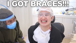 I GOT BRACES Philippines [upl. by Hcirdeirf883]