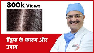 How To Get Rid Of Dandruff  डैंड्रफ के कारण और उपाय  HairMD Pune  In HINDI [upl. by Hgielsa]