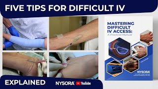 IV TIPS THAT MAKE A DIFFERENCE [upl. by Dimitri]