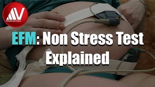 Nonstress Test Explained [upl. by Teador]