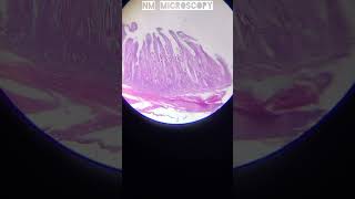 Unstriated smooth muscle tissue under microscope🔬youtubevideo [upl. by Dill915]