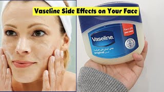 Vaseline on Face  Watch FIRST Before Using [upl. by Trimmer]