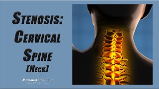 Cervical Spine Stenosis  Best Exercises to Decrease Pain and Other Symptoms [upl. by Kilam282]