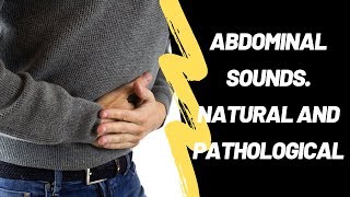 Abdominal Sounds Natural And Pathological [upl. by Annia]