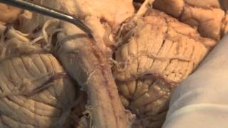 The Most Important Pathway Motor Control Neuroanatomy Video Lab  Brain Dissections [upl. by Neisa376]