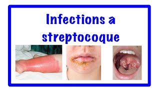 🔵infection à streptocoque 👹 streptococcies [upl. by Casandra]