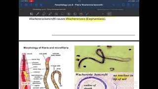 wuchereria bancrofti [upl. by Suqram]