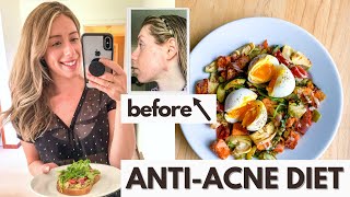 AntiAcne Diet What I Eat in a Day for Hormonal Acne [upl. by Etessil762]