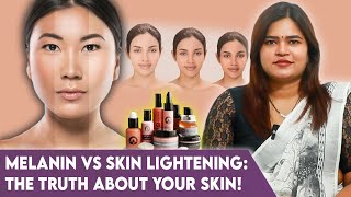 உங்க Skinக்கு ஏன் Melanin முக்கியம்  DrRadha Dermatology [upl. by Eiral938]