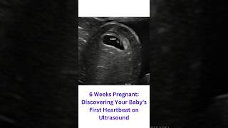 Witnessing My Babys Heartbeat for the First Time at 6 Weeks baby 2dpregnancy reels pregnant [upl. by Maitund]