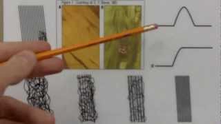 4  Tendinosis Tendinopathy Explained  Not Tendinitis [upl. by Leacock]