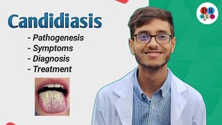 Candida albicans  Candidiasis  Opportunistic fungi  Microbiology bangla lecture [upl. by Naejeillib]