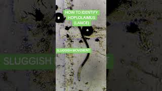 HOW TO IDENTIFY HOPLOLAIMUS LANCE NEMATODEmicroscope nematodes ppn agriculture stem [upl. by Ely]