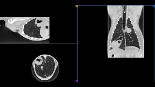 Thoracic masses in canine patient scanned by Vimago HDVI CT [upl. by Ihcelek]