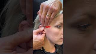 Epic Ear Adjustment chiropractic asmr chiropractor adjustment trending [upl. by Enar]