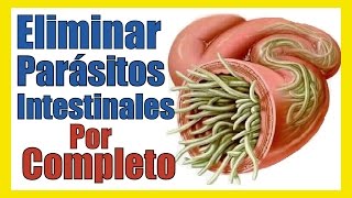 OXIUROS TRATAMIENTO para Desparasitar y Quitar PARASITOS INTESTINALES o LOMBRICES Remedios Caseros [upl. by Dnob304]