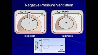 An Introduction to Mechanical Ventilation Mechanical Ventilation  Lecture 1 [upl. by Robson167]