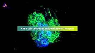 Revolutionizing the monitoring of CAR T cell therapies against solid tumors with the 3D imaging [upl. by Block]