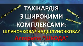 ТАХІКАРДІЯ З ШИРОКИМИ КОМПЛЕКСАМИ на ЕКГ ШЛУНОЧКОВА ЧИ НАДШЛУНОЧКОВА ВІДМІННОСТІ АЛГОРИТМ ДІЙ [upl. by Syramad325]