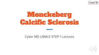 Monckeberg Calcific Sclerosis [upl. by Boehmer]