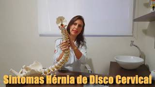 Sintomas Hérnia de Disco Cervical [upl. by Quickel]