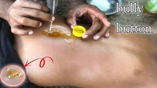 Belly button massage with oil  belly button massage for weight lossbullybutton [upl. by Smukler]